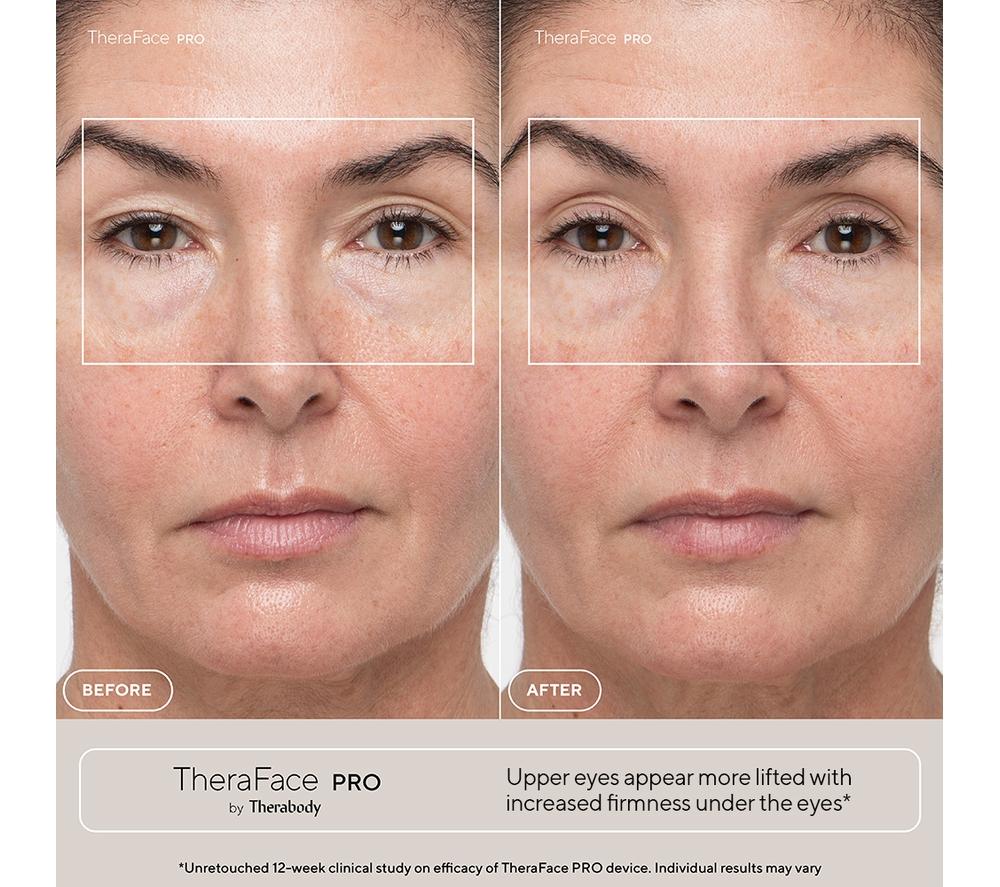 THERABODY TheraFace Pro Face Massager - White image number 3 of 10