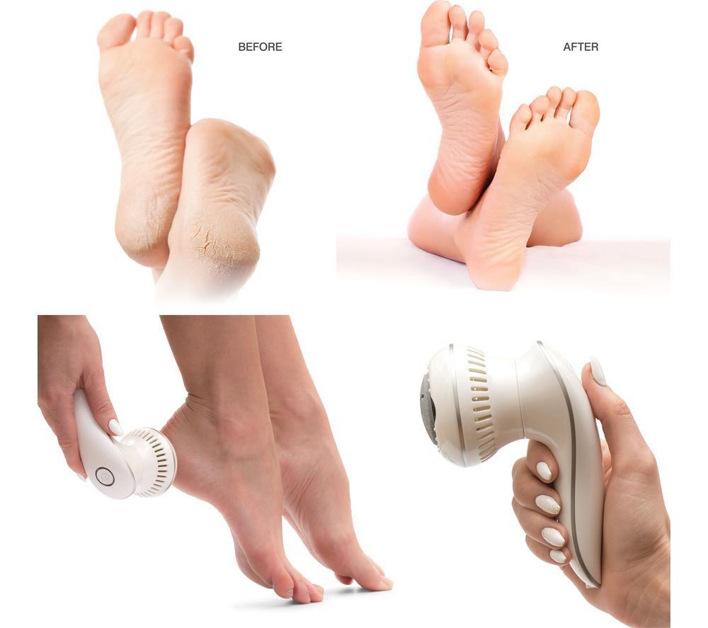 RIO 60 Second Spa Pedi Electric Foot File - White image number 6 of 6