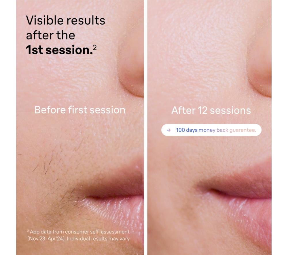 BRAUN Skin i&middot;expert IPL7147 IPL Hair Removal System - Rose Gold & White image number 4 of 9