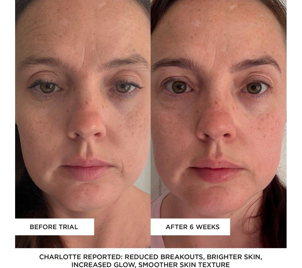 BEAUTYPRO Photon LED Therapy Mask - Grey image number 12 of 16