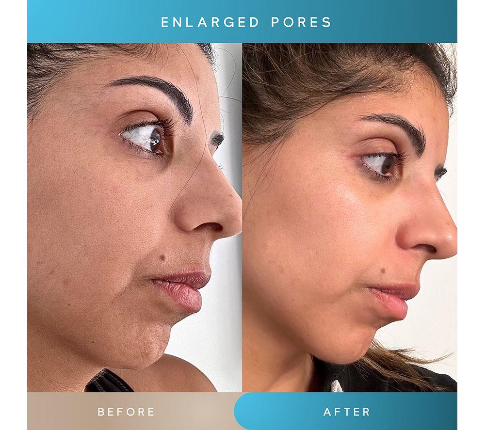 SENSSE FIRMIFY 3-in-1 Skin Sculpting Wand image number 22 of 23
