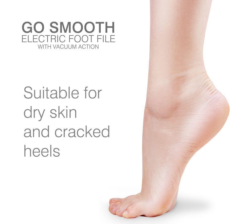 RIO Go Smooth Electric Callus Remover - White & Gold image number 4 of 8