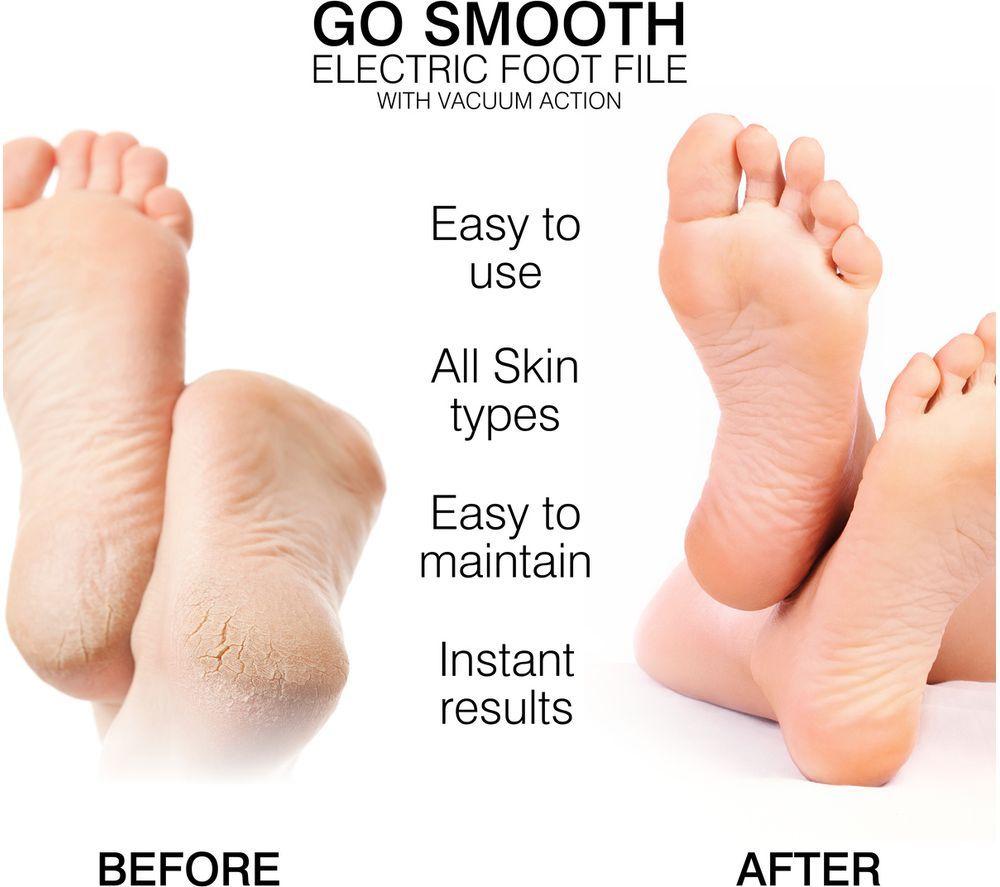 RIO Go Smooth Electric Callus Remover - White & Gold image number 5 of 8