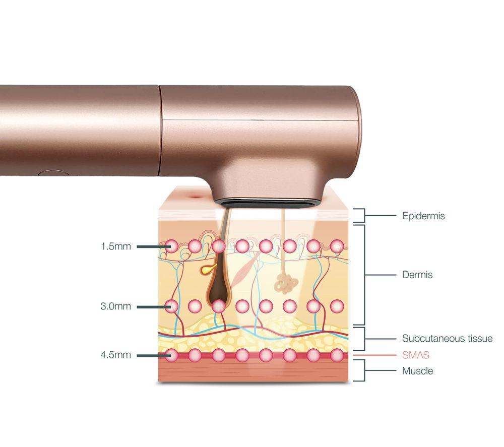 PURE TONE Innocera Platinum HIFU Skin Tightening and Lifting Tool - Bronze image number 2 of 20
