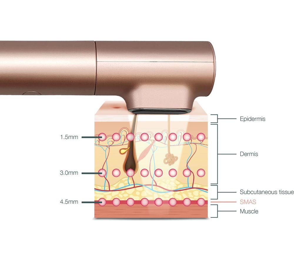 PURE TONE Innocera Platinum HIFU Skin Tightening and Lifting Tool - Bronze image number 10 of 20