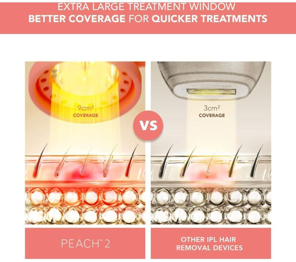 FOREO Peach 2 IPL Hair Removal System - Peach image number 6 of 6