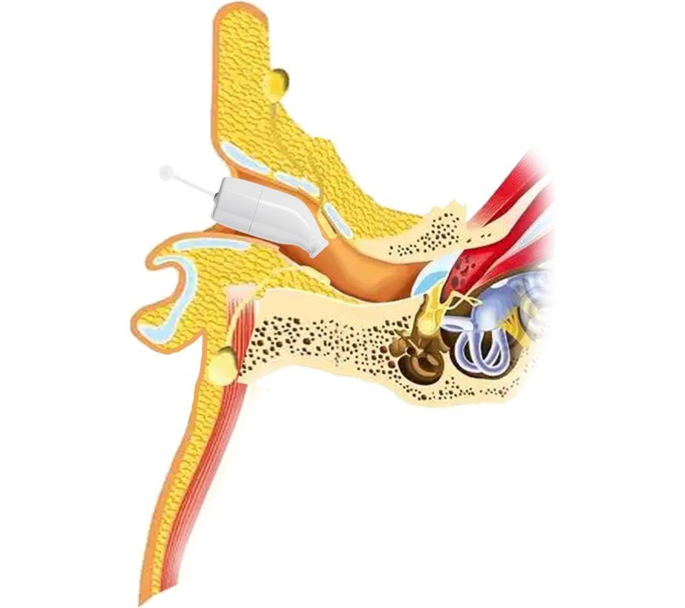 CERETONE Core One Pro CE-A80 In-Ear Canal Hearing Aids - Beige image number 8 of 9