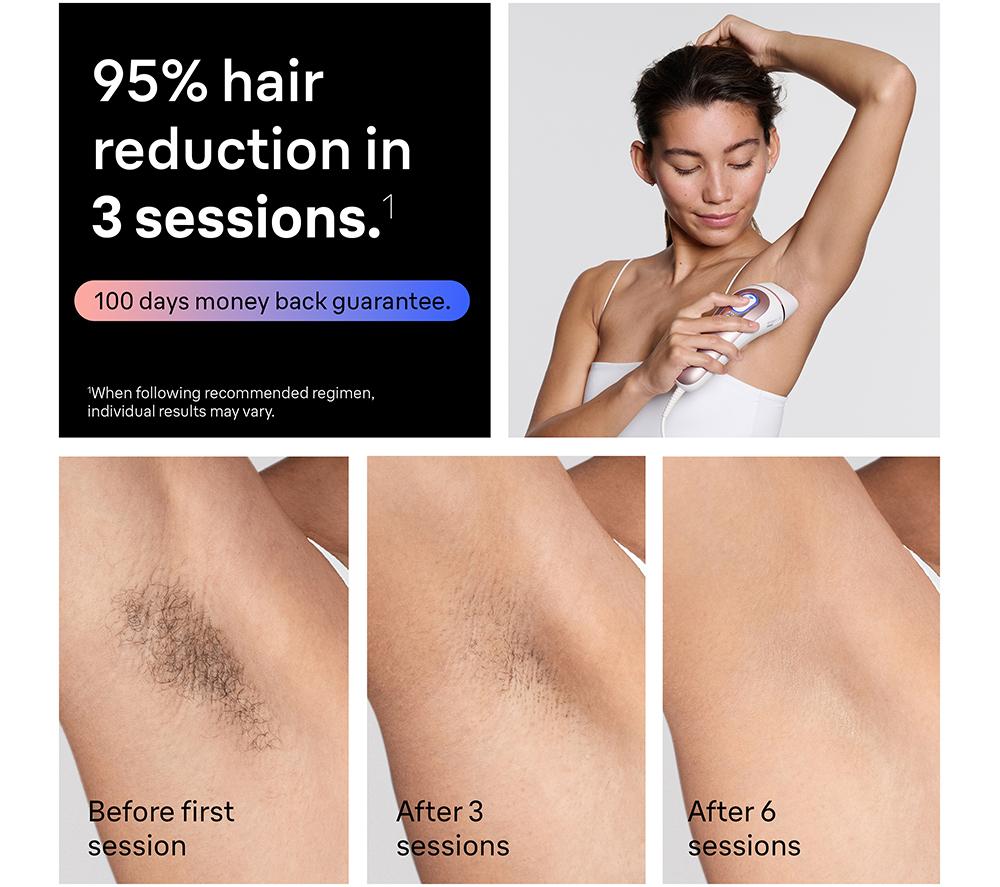 BRAUN Skin i&middot;expert PL7211 IPL Hair Removal System - White image number 6 of 11