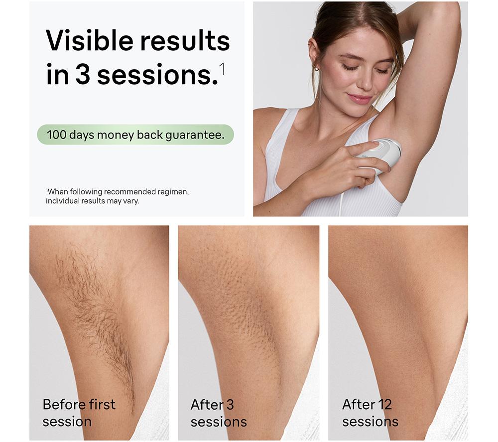 BRAUN  Silk-expert Mini PL1114 IPL Hair Removal System - White image number 3 of 8