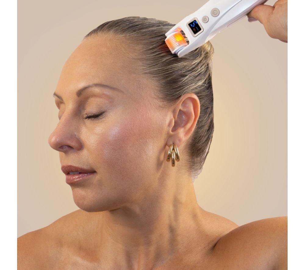 SENSSE SNSEMN01 MicroGlo Microneedling & EMS Device - Nude image number 6 of 8
