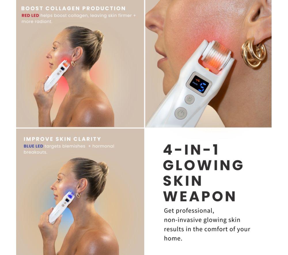 SENSSE SNSEMN01 MicroGlo Microneedling & EMS Device - Nude image number 7 of 8