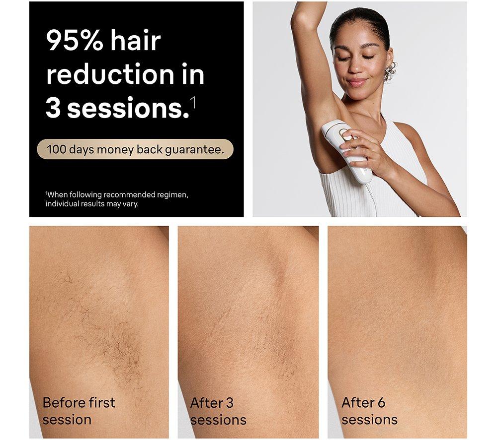 BRAUN Silk-expert Pro 5 PL5221 IPL Hair Removal System - White image number 4 of 8