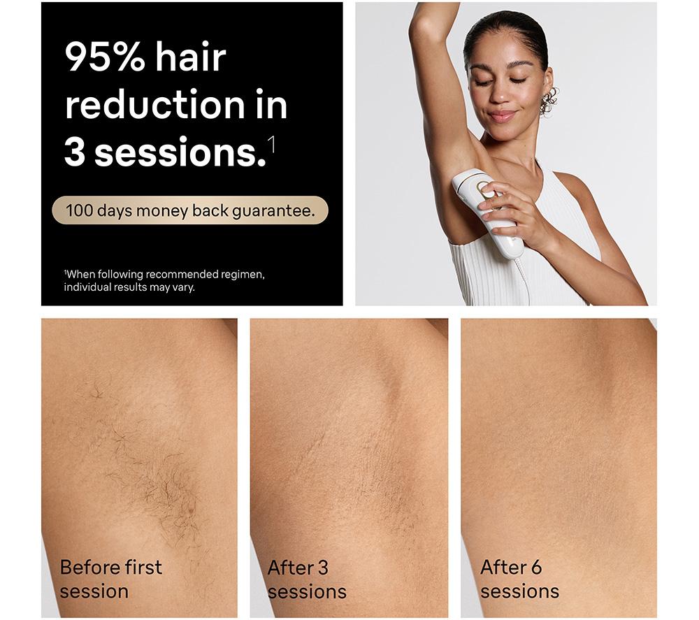 BRAUN Silk-expert Pro 5 PL441 IPL Hair Removal System - White image number 4 of 8