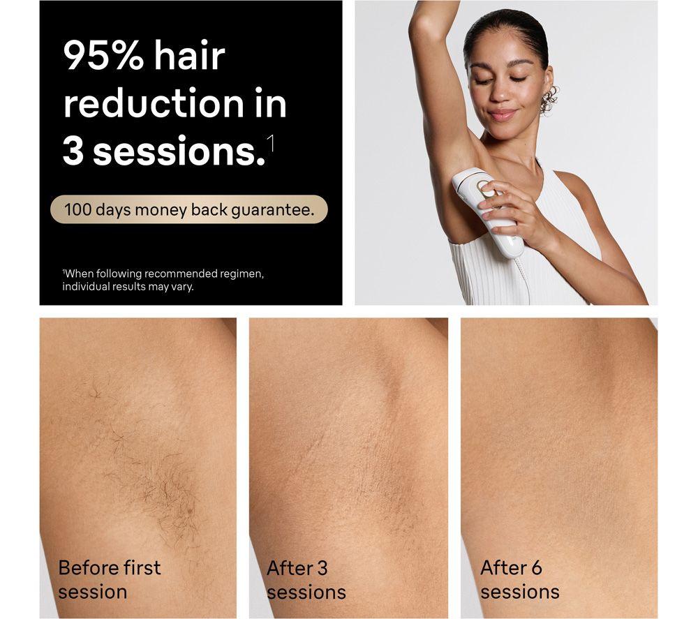 BRAUN Silk-expert Pro 5 PL5351 IPL Hair Removal System - White image number 7 of 15