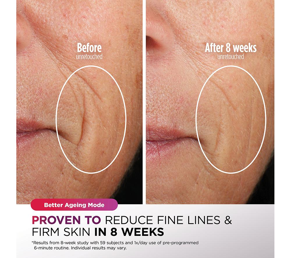 SHARK FW312IEPL CryoGlow Under-Eye Cooling LED Anti-Ageing & Blemish Repair Mask &ndash; Lilac Chill image number 5 of 12