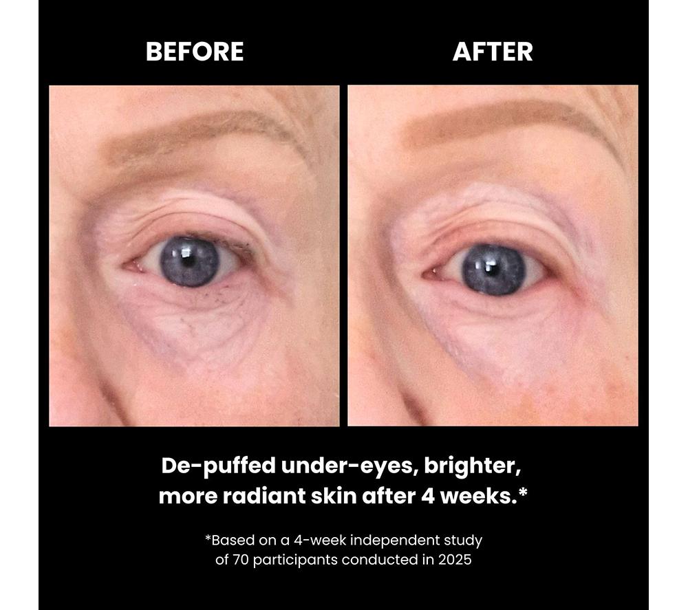 LUSTRE GoGlow LED Under Eye Patches - White image number 9 of 9
