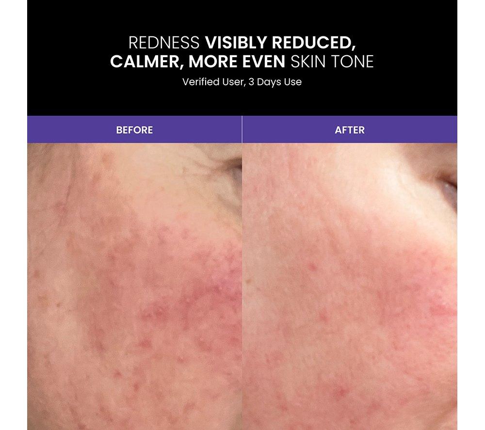 LUSTRE Renew Pro LED Face Mask - White image number 9 of 10