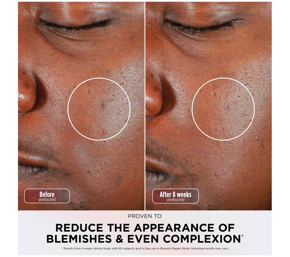 SHARK FW312UKPK CryoGlow Under-Eye Cooling LED Anti-Ageing & Blemish Repair Mask &ndash; Rose Glow image number 9 of 14