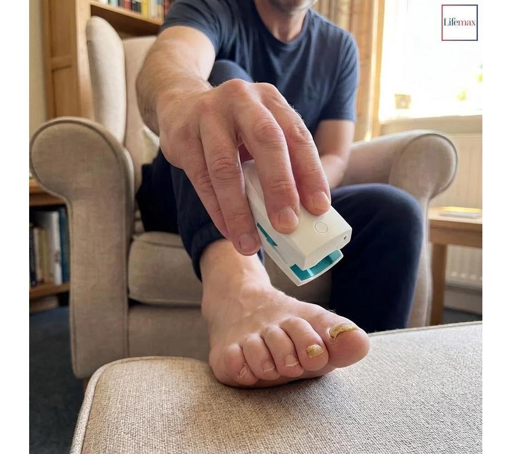LIFEMAX Laser Nail Treatment image number 2 of 4