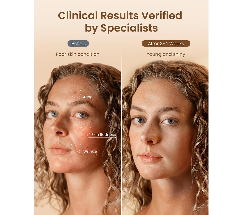 RENPHO Artemis Blush 4-Mode LED Face Mask - White image number 5 of 9