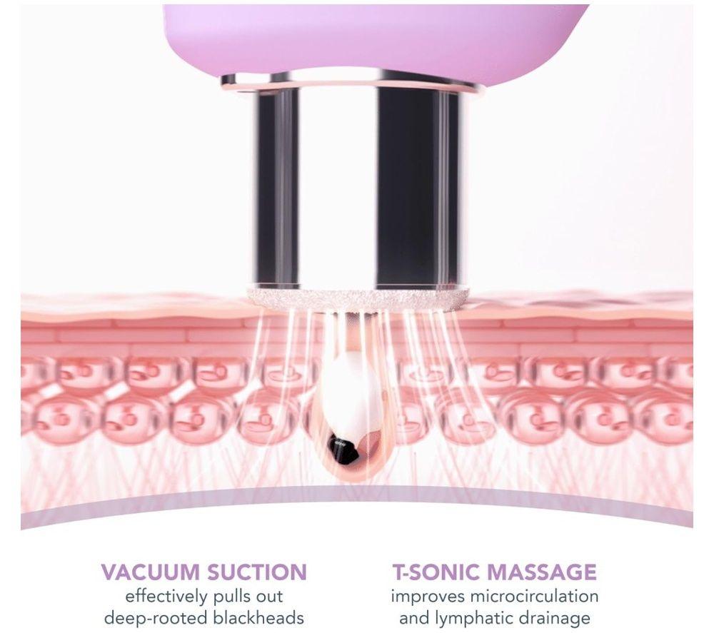 FOREO FO1955 KIWI Derma Microdermabrasion Pore Vacuum - Lavender image number 4 of 9