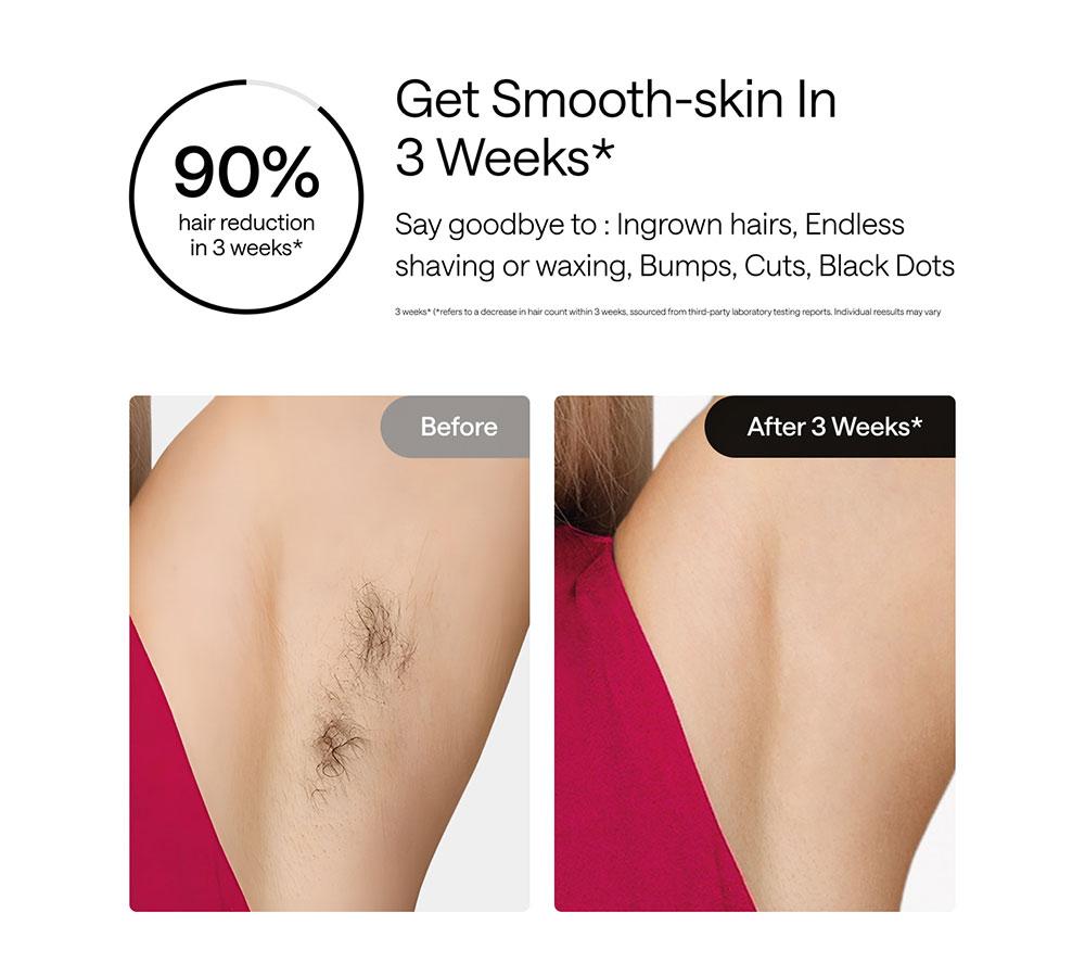 ULIKE Air 3 IPL Hair Removal System - Pink image number 4 of 10