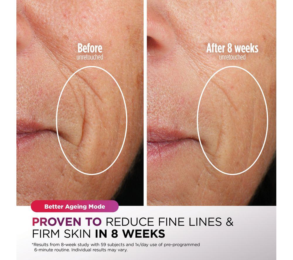 SHARK FW312UK CryoGlow Under-Eye Cooling LED Anti-Ageing & Blemish Repair Mask &ndash; Lilac Chill image number 6 of 15